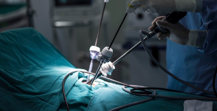 minimal invasive surgery